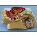 Medical Teaching Male Pelvis Anatomical Model with Common Disease